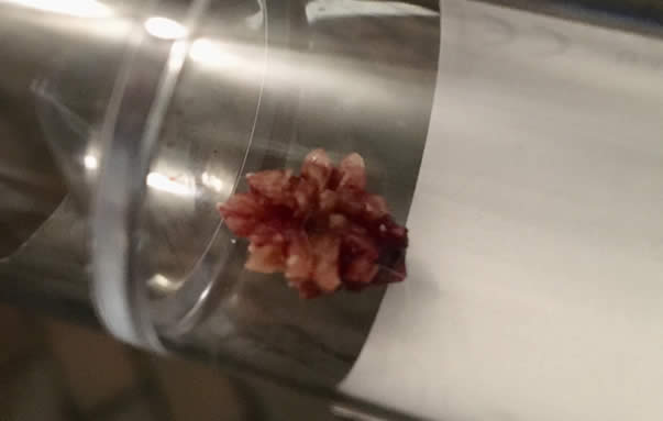 Crystal formed in bladder of a dog on a vegan diet